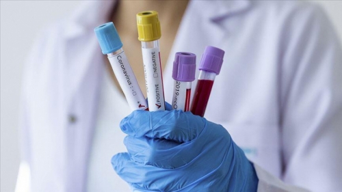 Günlük vakalar 7.839'a ulaştığında koronavirüs ölümleri 46.268'e ulaştı